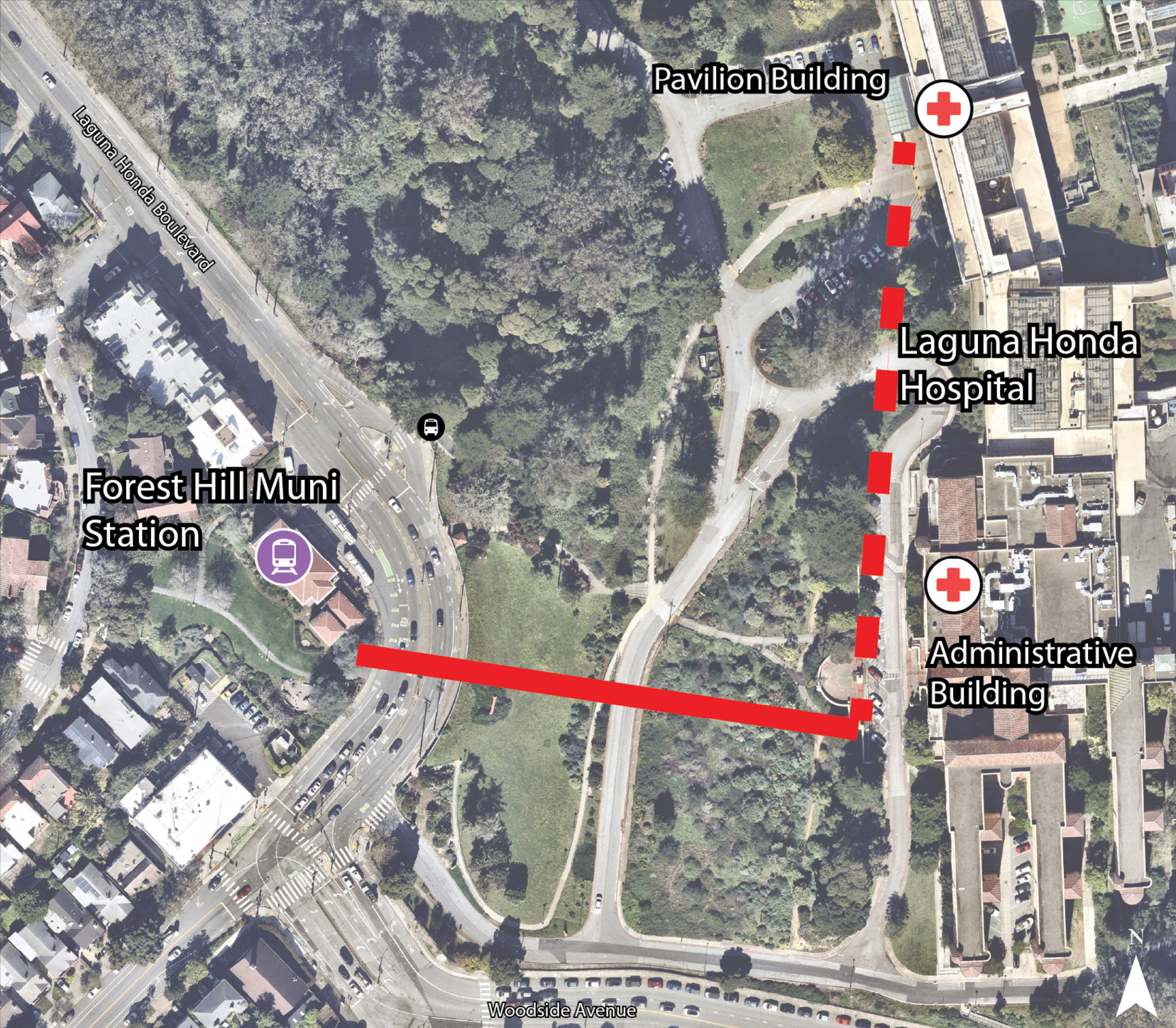 Map illustrating conceptual gondola alignment alternative 1A. The alignment connects Forest Hill Muni Station to the Laguna Honda Hospital Administrative Building, with a potential future extension to the Pavilion Building.