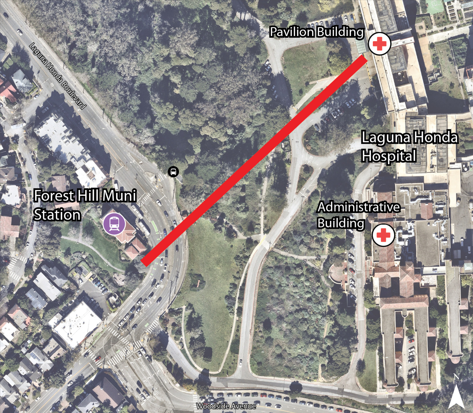 Map illustrating conceptual gondola alignment alternative 1B. The alignment connects Forest Hill Muni Station directly to the Laguna Honda Hospital Pavilion Building.