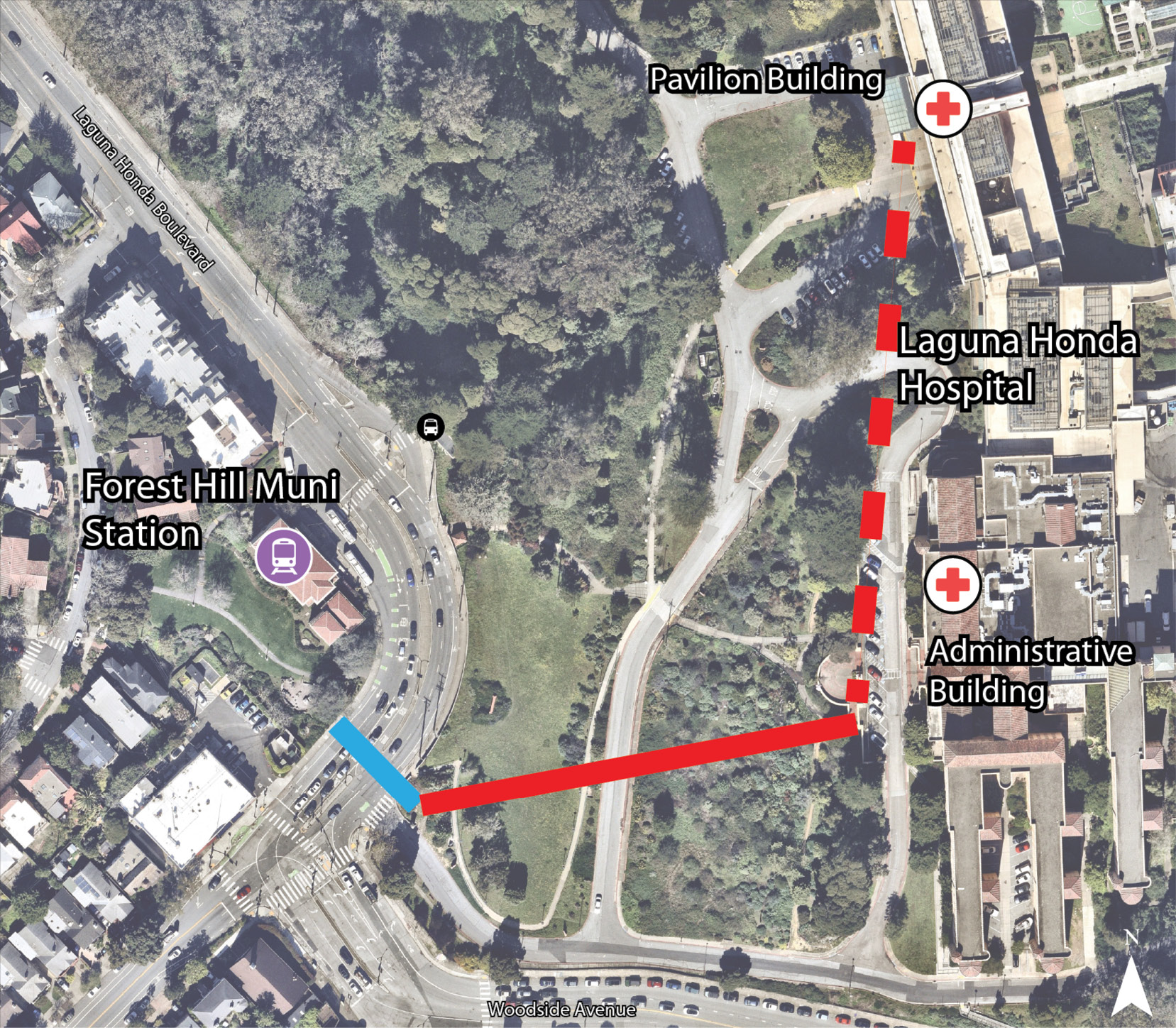 Map illustrating conceptual gondola alignment alternative 2A. The alignment begins across Laguna Honda Boulevard from Forest Hill Muni Station and connects to the Laguna Honda Hospital Administrative Building, with a potential future extension to the Pavilion Building.