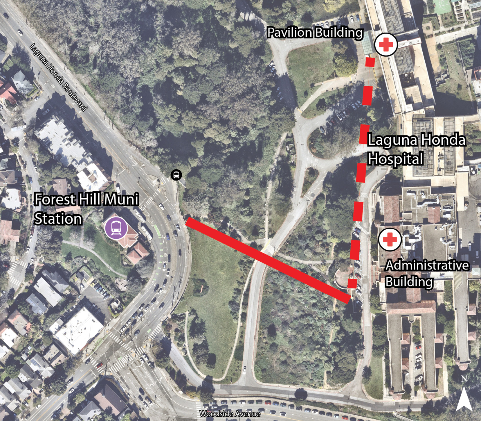 Map illustrating conceptual gondola alignment alternative 2B. The alignment begins across Laguna Honda Boulevard from Forest Hill Muni Station and connects to the Laguna Honda Hospital Administrative Building, with a potential future extension to the Pavilion Building.